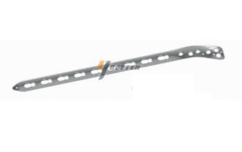 locking plate system