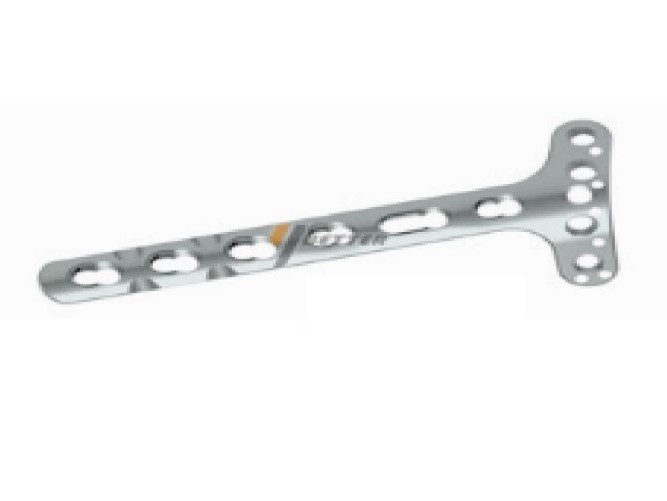 locking plate system